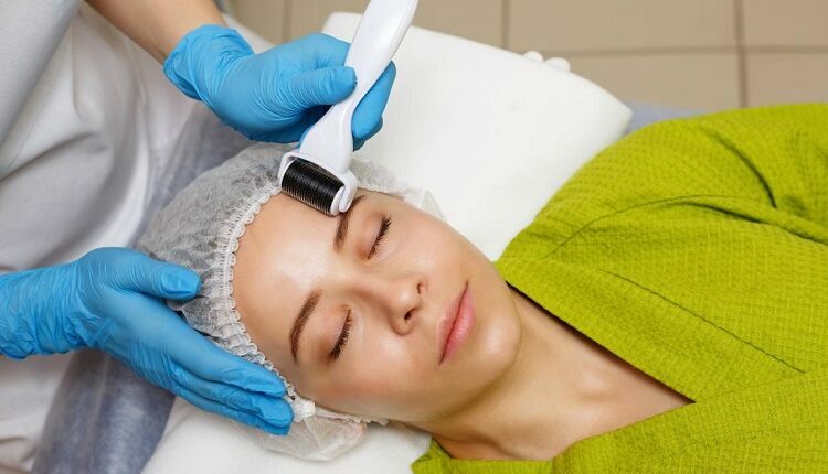 Is Microneedling The Ideal Procedure For Skin Rejuvenation