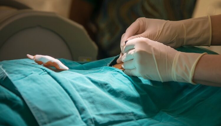 Lumbar Epidural Steroid Injections