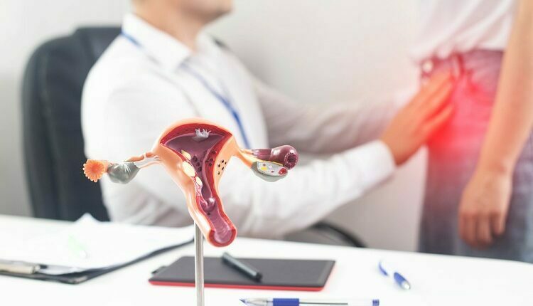 Uterine Fibroids