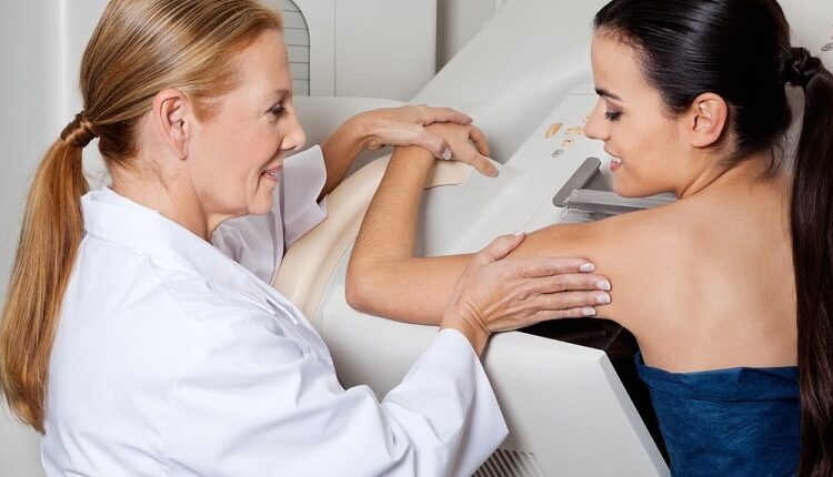 Mammography Screening
