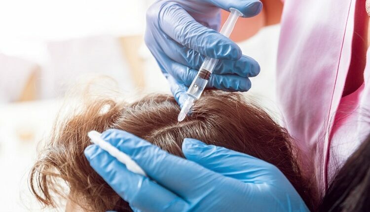 Platelet-Rich-Plasma Therapy