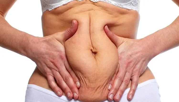 Tightening Loose Skin