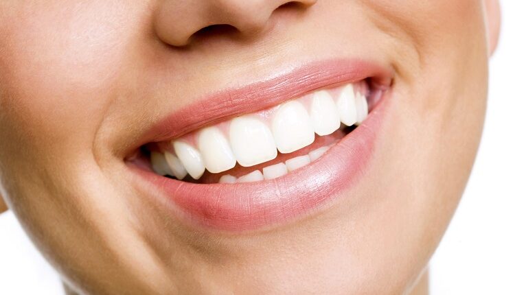 Teeth Whitening